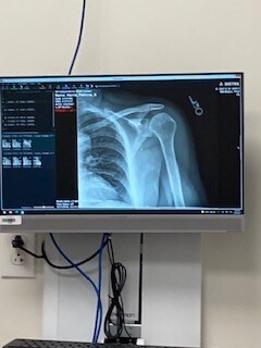 shoulder pain.  root cause of pain. chiropractic care for women.  neck pain.  shoulder pain chiropractic. 